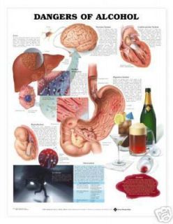 Dangers of Alcohol Anatomical Chart/Charts/M​odel