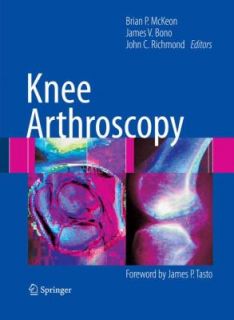 Knee Arthroscopy by Brian P. McKeon, James V. Bono and John C 