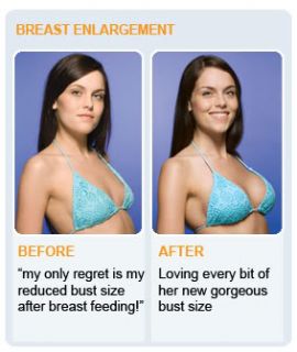 Breast Enlargement Pill Enhancement Herb Breast Apex