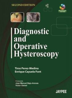 Diagnostic and Operative Hysteroscopy by Font 2011, Mixed Media